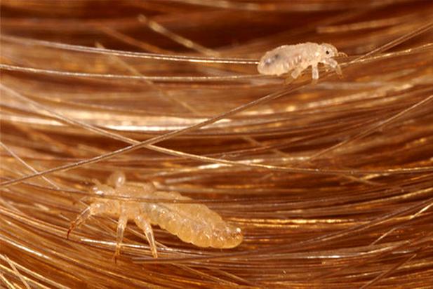 Head lice investation