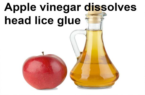 vinegar dissolves head lice eggs glue